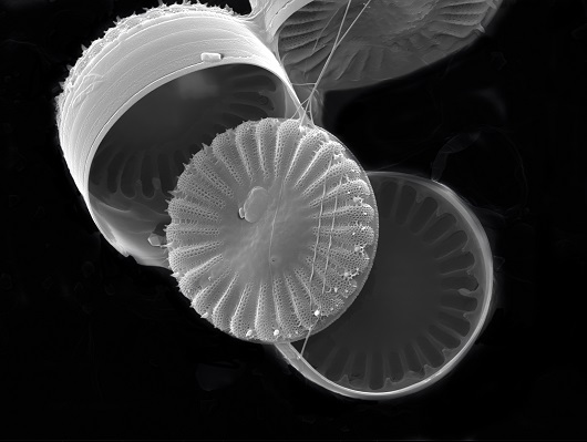 Imagem em preto e branco de um microorganismo em formato arredondado (Foto: João Victor Serra Nunes)