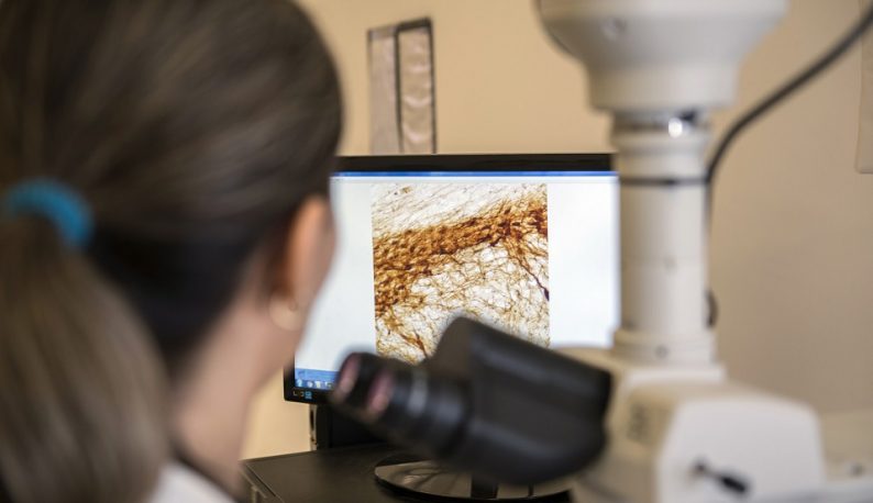 Pesquisadora estuda efeitos da BBG em microscópio com imagem de célula ao fundo (Foto: Jr. Panela/UFC)