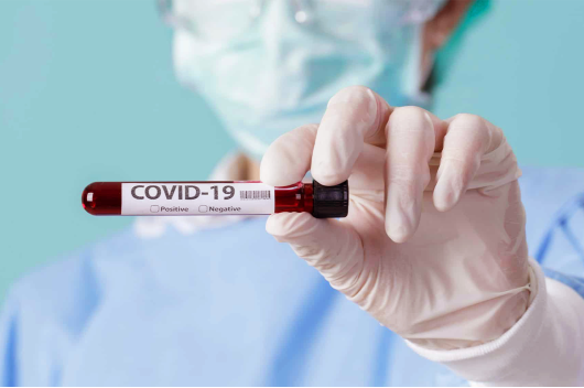 Agente de saúde segurando uma amostra de sangue etiquetada com o nome covid-19