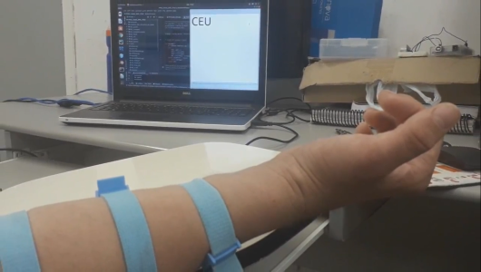 O sistema de detecção de movimentos no braço de um usuário