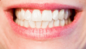 Sorriso de uma mulher com dentes expostos