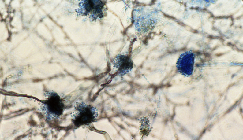 Imagem microscópica do fungo Aspergillus fumigatus, que tem coloração azul