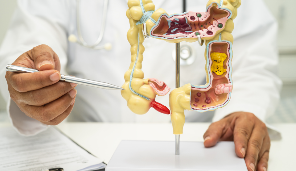 Médico mostrando modelo de intestino