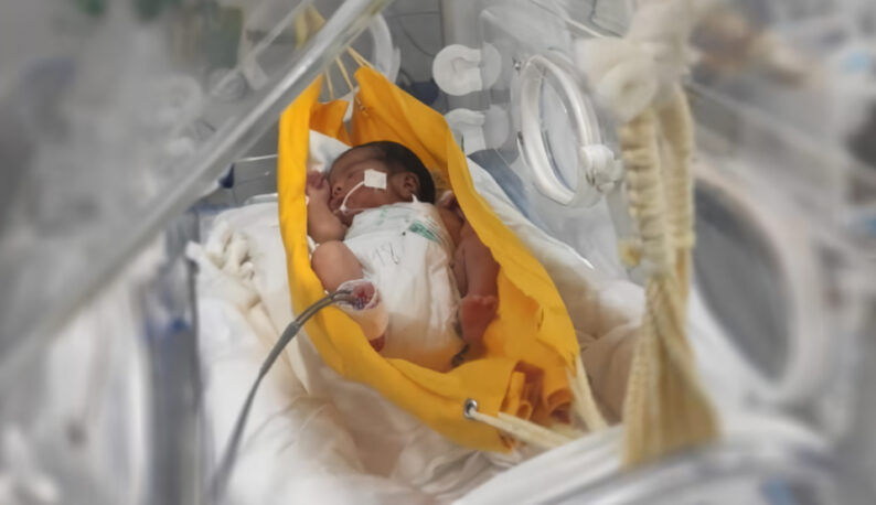 Imagem: bebê deitado em rede posta em incubadora